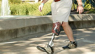 Lower Limb Prosthetics Services - Al Rehab