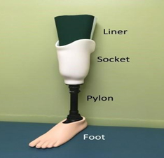 Below knee prosthesis
